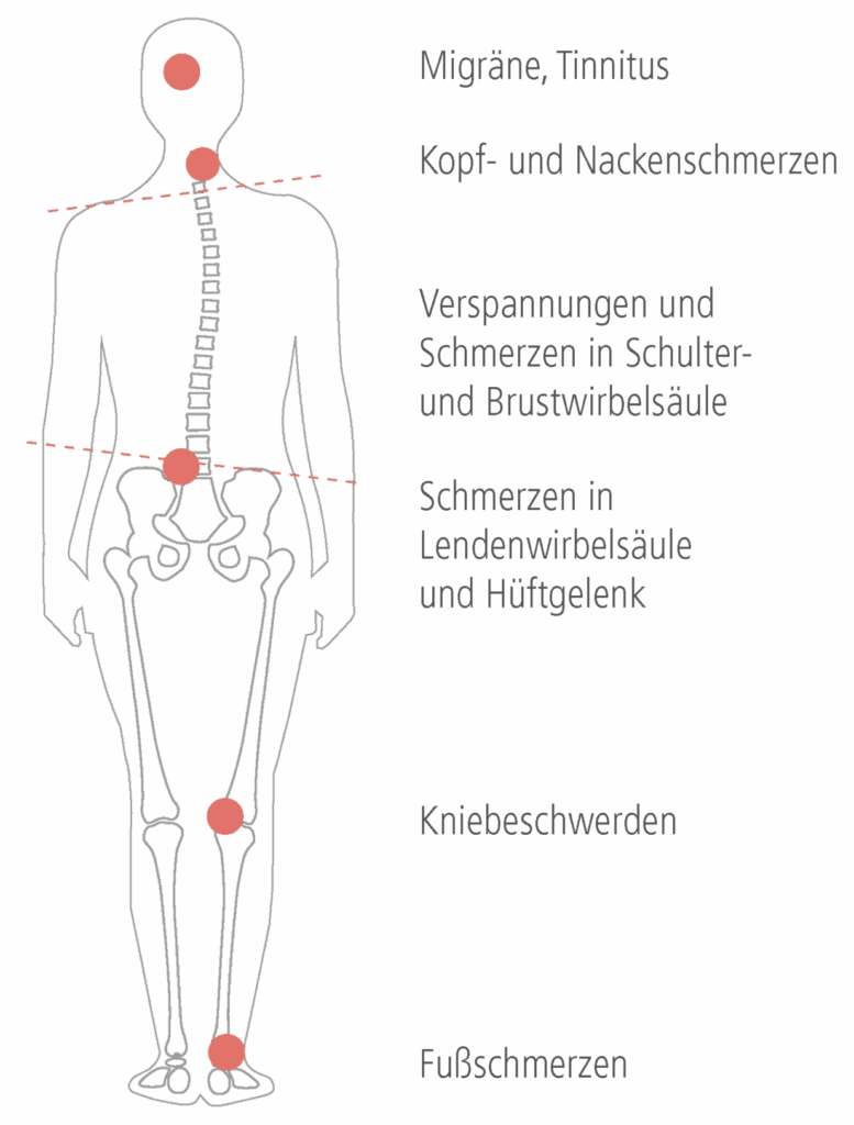 CMD Funktionsanalyse